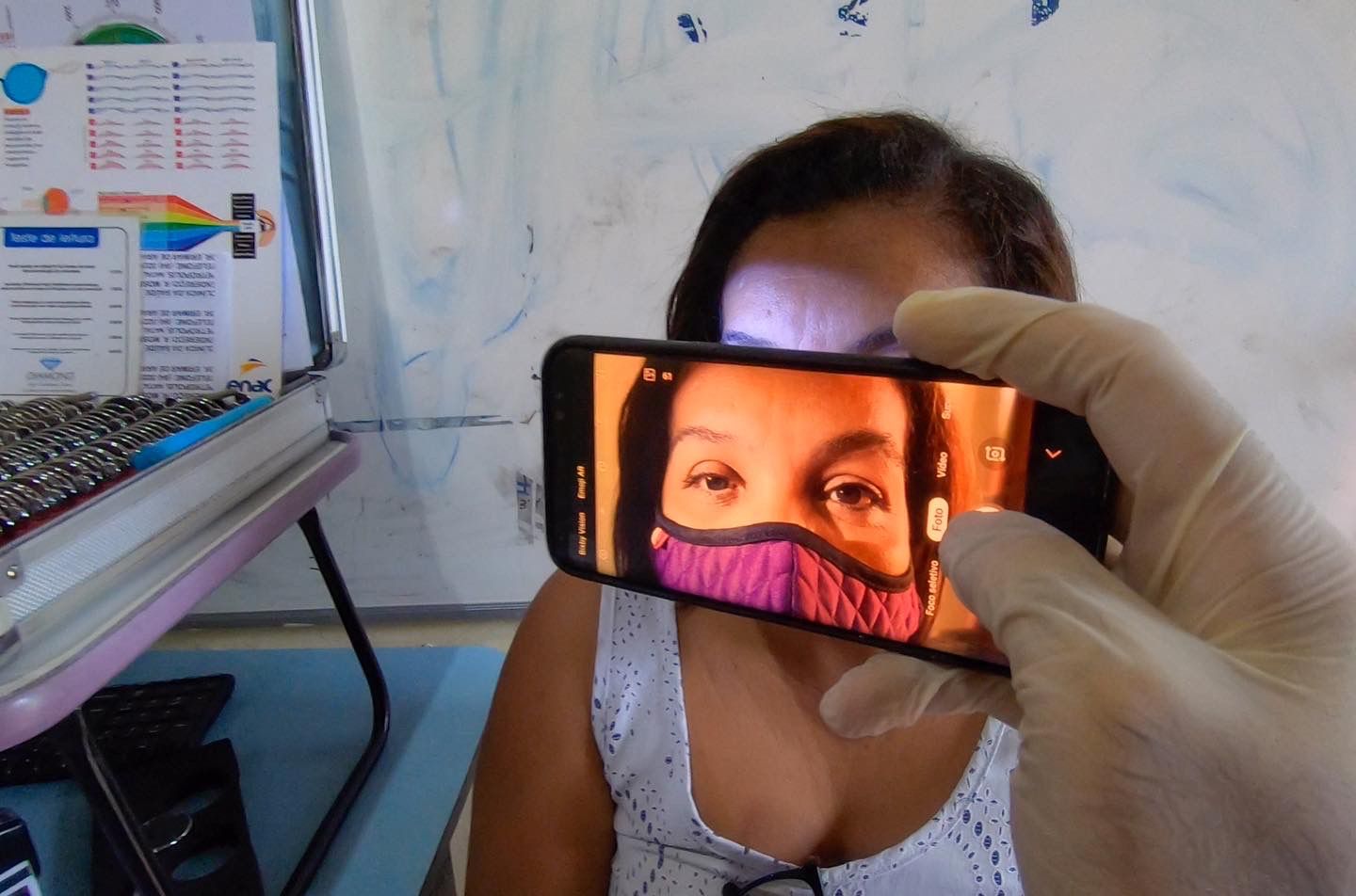Canguaretamense recebe prótese ocular gratuitamente